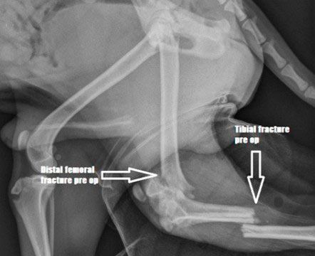 Broken leg x-ray